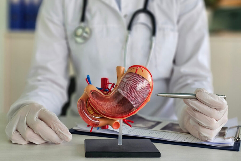 Gastrisk bypass i Tyrkia