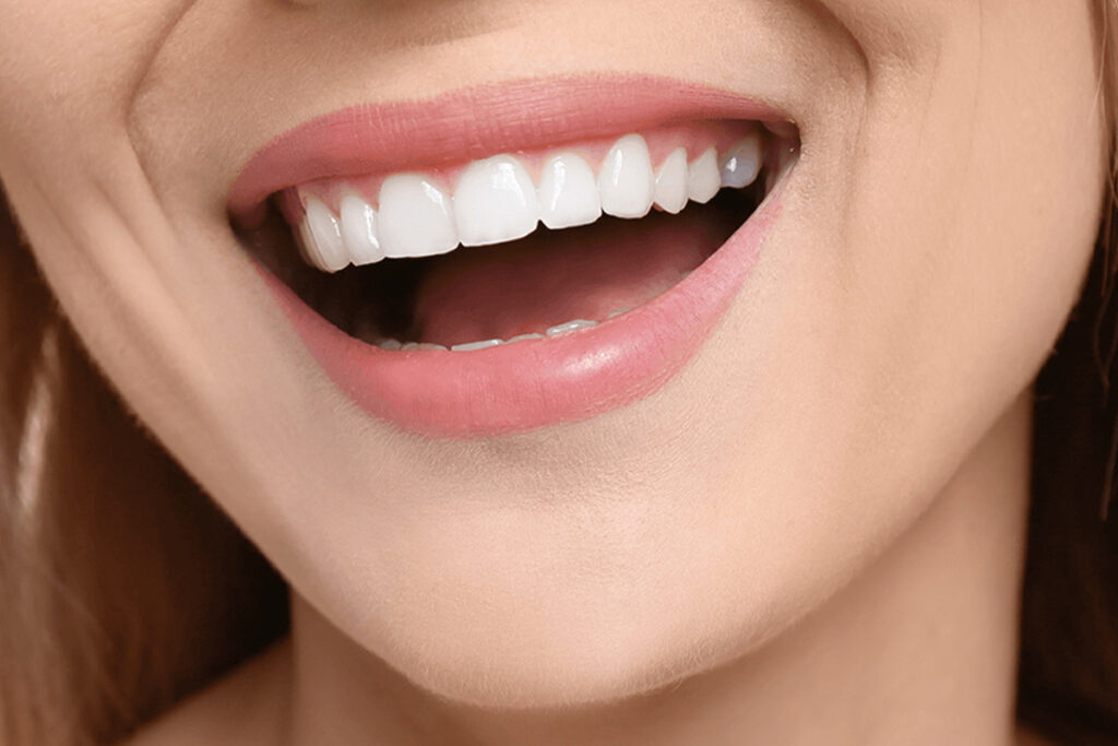 Hollywood Smile i Tyrkia