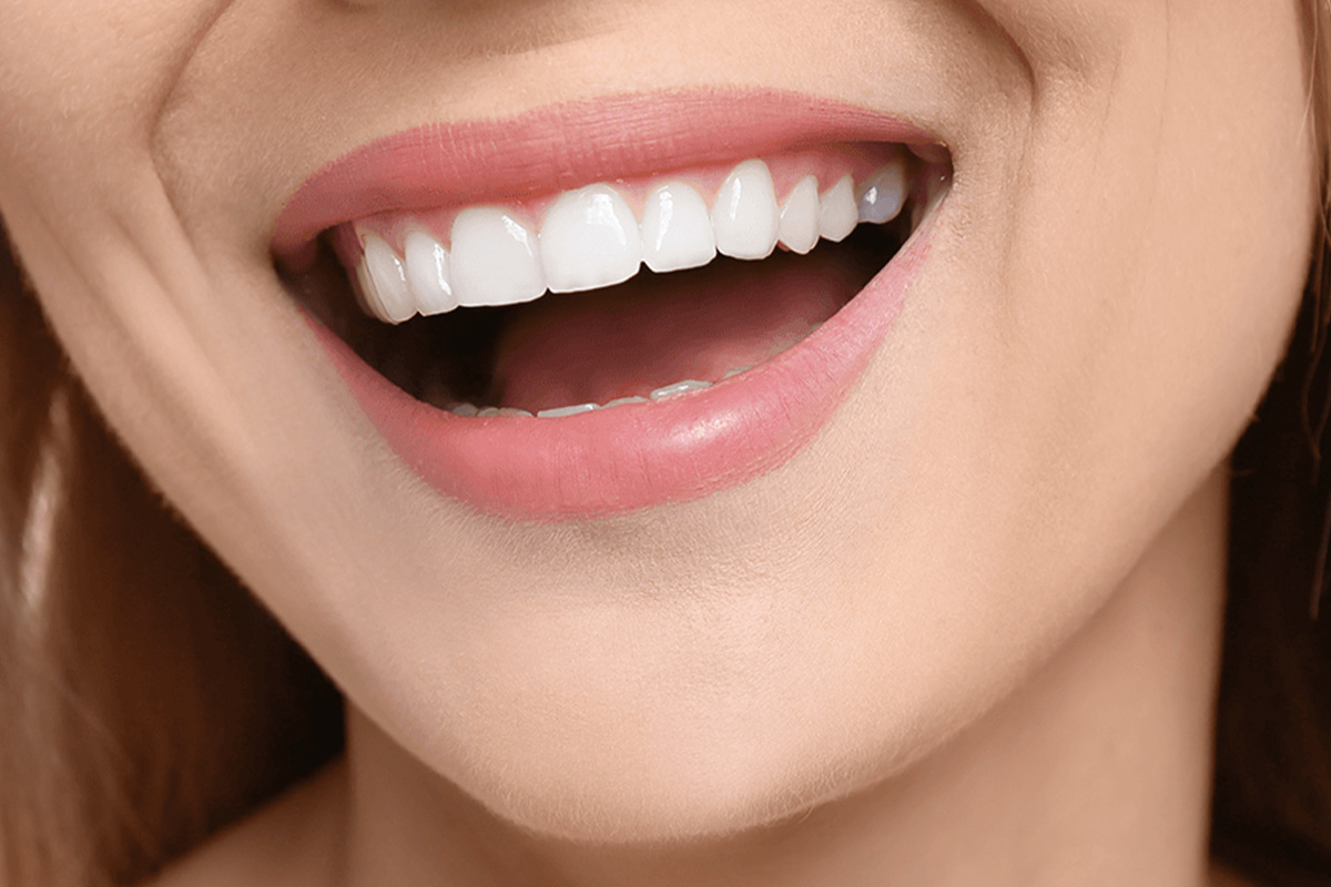 Hollywood Smile i Tyrkia